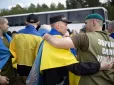 За кілька місяців майже нічого не залишиться: Український воїн, якому кати в полоні випалили на тілі 